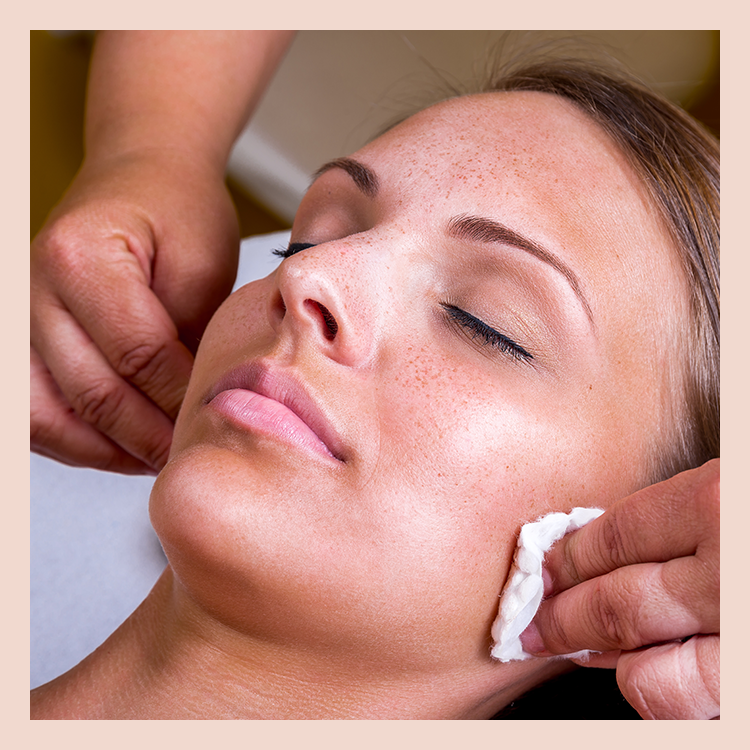 Chemical Peel Specials Ft. Lauderdale