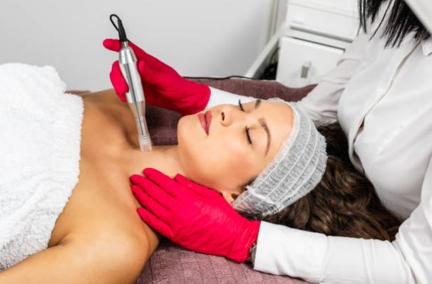 Microneedling Fort Lauderdale
