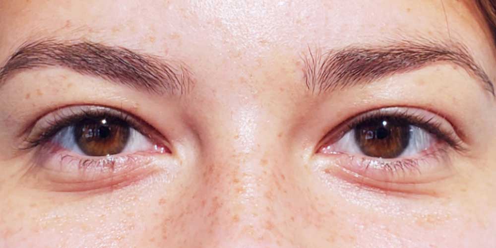 11_Eyelash_curl_before