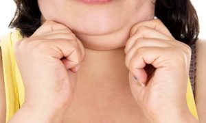 Read more about the article What are the Benefits of Kybella®?