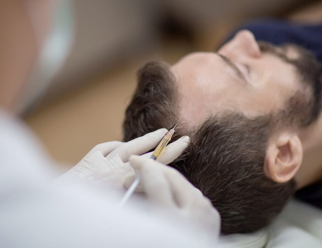 Hair restoration with PRP